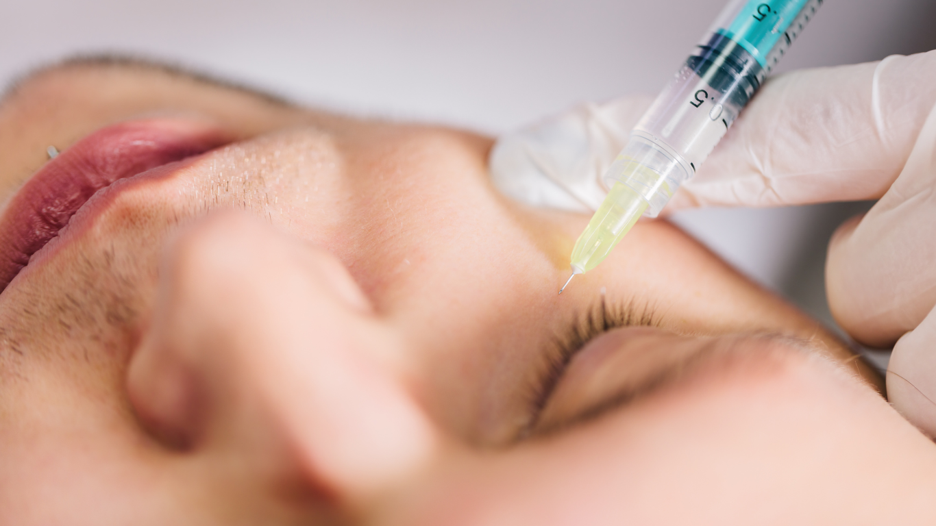 Bioestimuladores de Colágeno: firmeza e rejuvenescimento natural