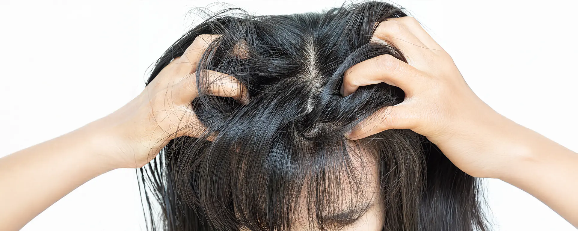 Coceira no couro cabeludo: quando o sintoma vai além da caspa